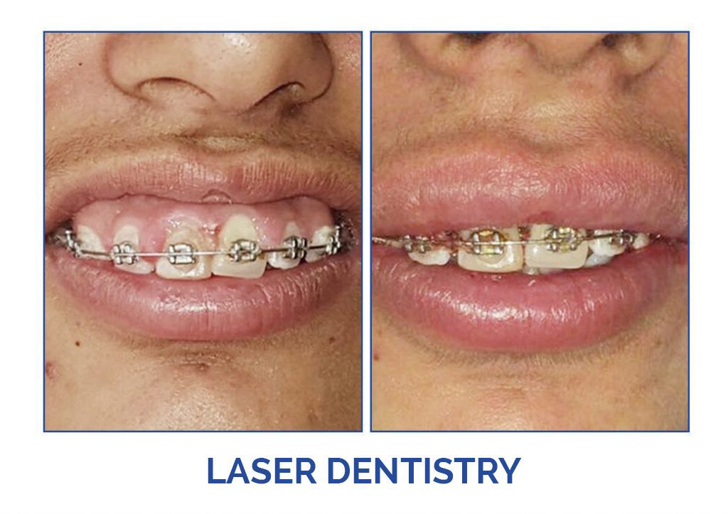 Dental Cosmetic Clinic - Dr Shobit sethi